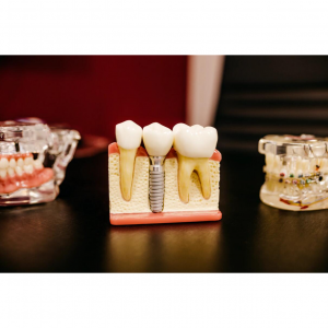 8个口碑好的美国牙齿保健产品网站推荐（附优惠码+10%返利）- 美白，防蛀，防龋齿，日常护理！！