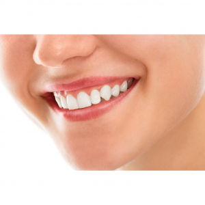 Dental Savings Plan vs. Dental Insurance: In-Depth Comparison and Verdict