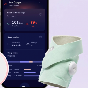 Owlet Baby Care - Dream Sock® 嬰兒智能監視器，現價$299.99 